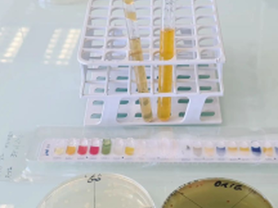 Instagram série STL Biotechnologies